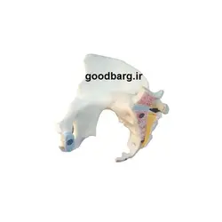 مولاژ لگن خاصره