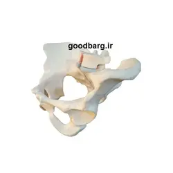 مولاژ لگن خاصره