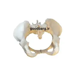 مولاژ لگن خاصره