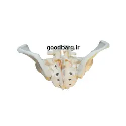 مولاژ لگن خاصره