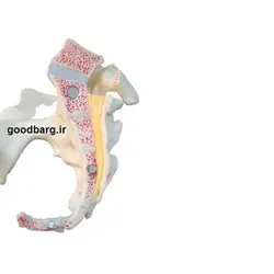 مولاژ لگن خاصره