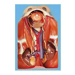مولاژ کلیه تفکیکی