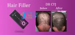 هیرفیلر ( هیر فیلر ) dr cyj hair filler