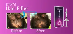 هیرفیلر ( هیر فیلر ) dr cyj hair filler
