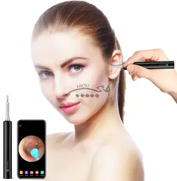 گوش پاک کن هوشمند شیائومی Bebird C3