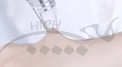 میکرودرم شیائومی Xiaomi InFace MS7000 Fcial Deep Cleaner