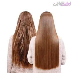 پکیج کلاژن سوپر لاکچری هونما