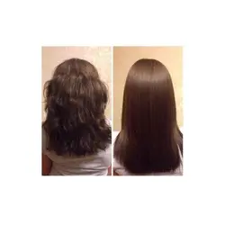 نانو بوتاکس فوق حرفه ای هونما توکیو honma