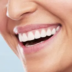 مسواک برقی اورال بی Oral-B مدل Vitality 100 Cross Action مشکی