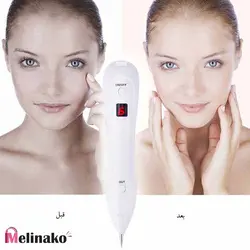 پلاسما پن 9 قدرته برای حذف تتو و خال مدل Spot Plasma Mole Pen Black Spot Remover