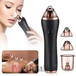 مکش و میکرودرم 4کاره سرد و گرم مدل  4In 1 Hot And Cold Massage Nose Blackheads Remover