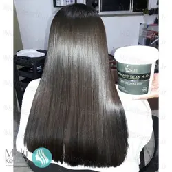 بوتاکس V4 وگ