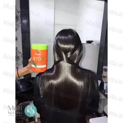 بوتاکس هویج ناتوریزا