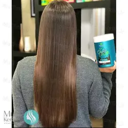 بوتاکس کافه ورده ناتوریزا