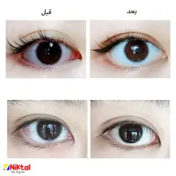 دستگاه مرطوب کننده چشم MIE306\101