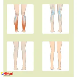 ماساژور ساق پا آیجویر KLK-701A