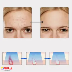 ماسک زیبایی و جوان کننده صورت JZC-M03-1