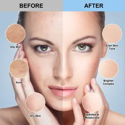 ماسک پودری هیدروژلی هیالورونیک اسید 650 گرمی نایس فرش