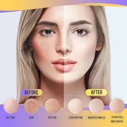 ماسک هیدروژلی 650 گرمی طلا نایس فرش