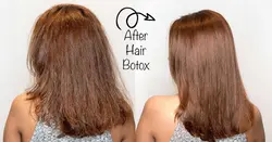 بوتاکس ام بی کیو MBQ BOTOX