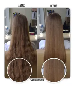 بوتاکس مو لونیکس ماندیوکا  Lunix