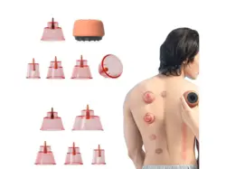 بادکش برقی هوشمند زدیر Zdeer Electric Cupping Therapy Smart Massager