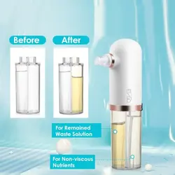 میکرودرم ابریژن انزو پروفشنال مدل ENZO EN-011