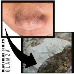 پک ماسک حذف جوش سر سیاه بینی بلک هد Off Blackhead Nose Mask