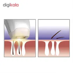 لیزر موهای زائد تاچ بیوتی مدل TB1755