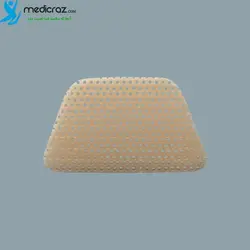 اسپلینت بینی خارجی ذوزنقه ای