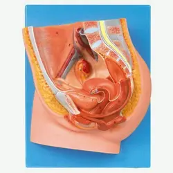 مولاژ مقطع میانی لگن زن 2 قسمتی