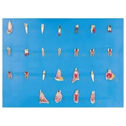 مولاژ مدل بیماری ها و امراض درمانی