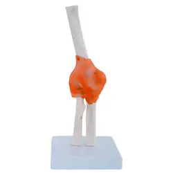 مولاژ مفصل آرنج با نمایش رباط ها