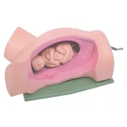 مولاژ چرخش جنین در هنگام زایمان