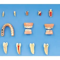 مولاژ مدل بیماری و امراض درمانی