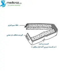 پنیل کلمپ کانینگهام شفانور