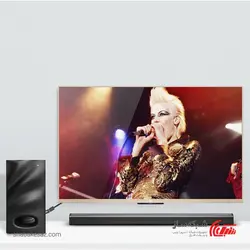 قیمت و خرید کابل صدا 2 RCA یوگرین Ugreen AV102 طول 5 متر - شبکه ساز