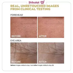 سرم جوانساز قدرتمند پروتینول Anew آون حجم 30 میل