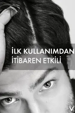 شامپو ضد شوره  Dercos مناسب موهای خشک  ویشی Vichy