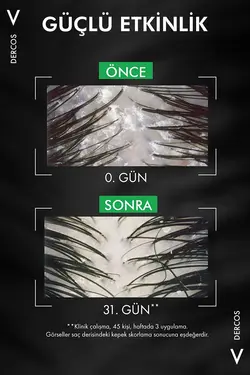 شامپو ضد شوره  Dercos مناسب موهای خشک  ویشی Vichy