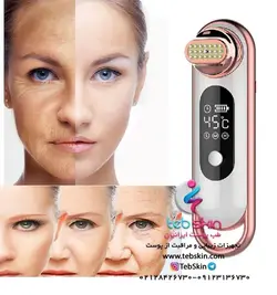 دستگاه پرتابل اسمارت آر اف EMS RF