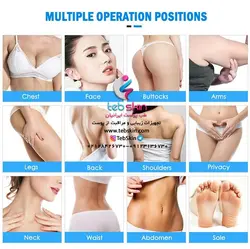 افزایش حجم سینه و باسن توسط دستگاه تمام دیجیتال