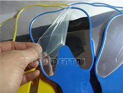 آینه بیمار طرح دندان