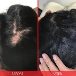 تقویت کننده مو هرتامین (Hairtamin Advanced)