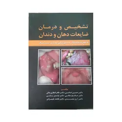 تشخیص و درمان ضایعات دهان و دندان