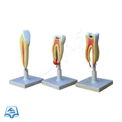 مولاژ دندان (سری 3 عددی) مدل ASM43