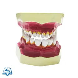 مولاژ دندان (نمایش تورم لثه) مدل ASM42