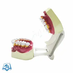 مولاژ دندان (نمایش تورم لثه) مدل ASM42
