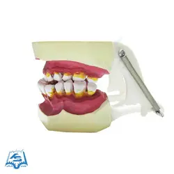 مولاژ دندان (نمایش تورم لثه) مدل ASM42