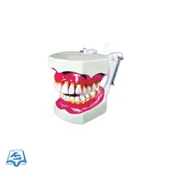 مولاژ دندان (نمایش تورم لثه) مدل ASM42